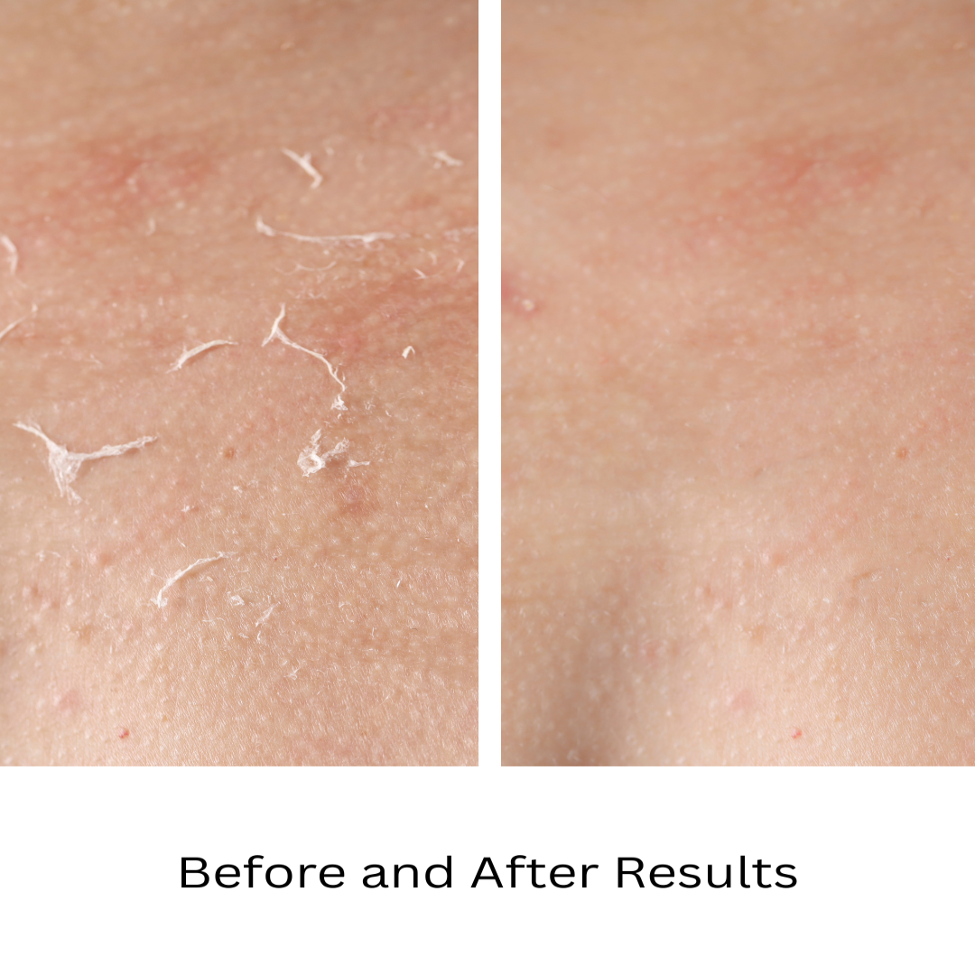 Organic Two-Step Facial for Dry Skin System Wash and Moisturizer - For WOMEN