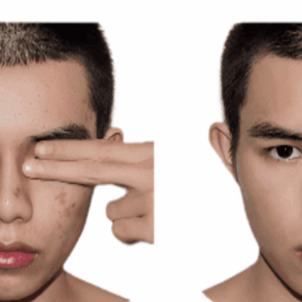 Anti-Acne Organic Facial Wash - For MEN
